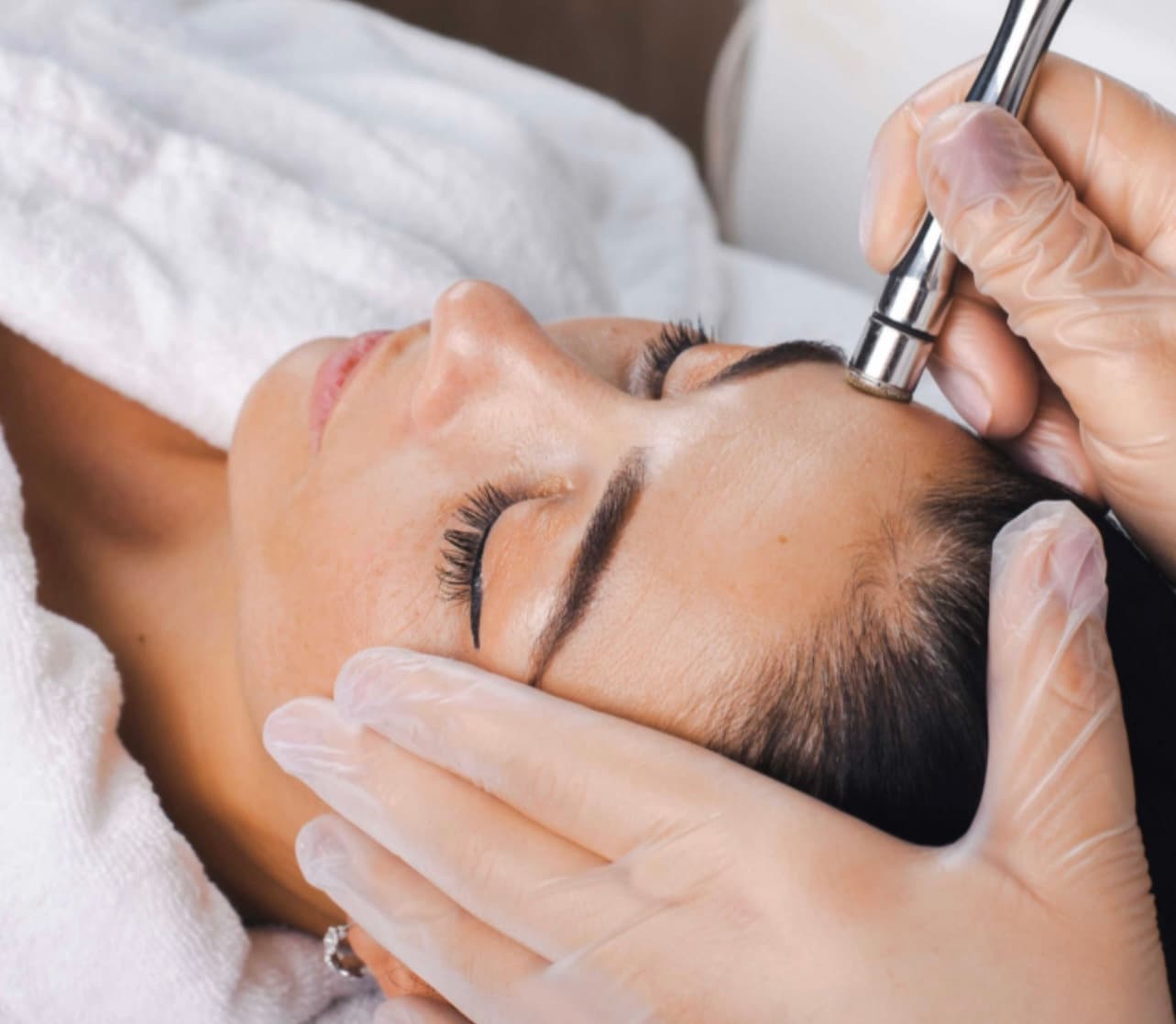 Micro/Hydro Dermabrasion